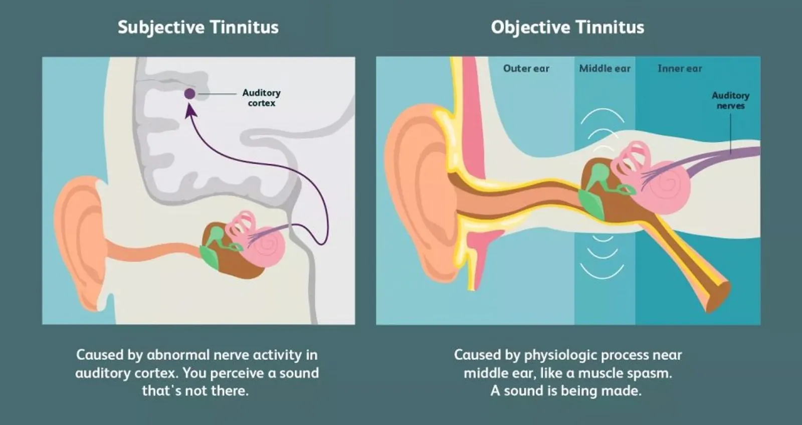 Tinnitus : relief through osteopathy | Osteopath Paris 16