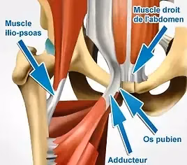 Muscles responsables de la pubalgie