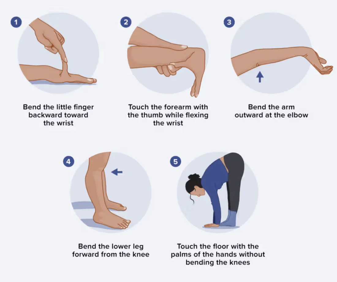 The 5 manoeuvres of the Beighton score used to assess joint hypermobility: little finger, thumb, elbow, knee and forward trunk flexion — osteopath Paris 16