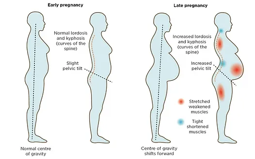 Changements posturaux chez la femme enceinte