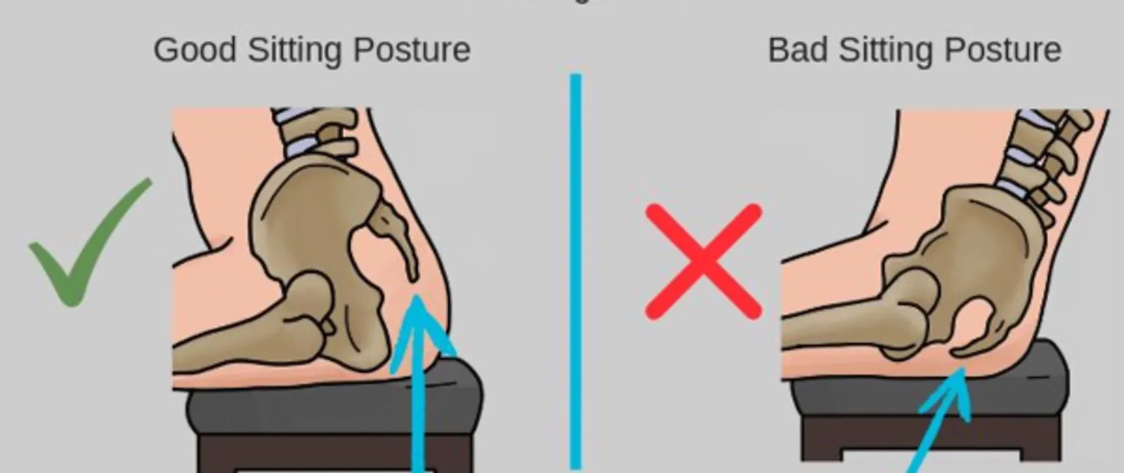 Conseil de posture pour éviter la douleur du coccyx par charbel kortbawi, ostéopathe à Paris 16