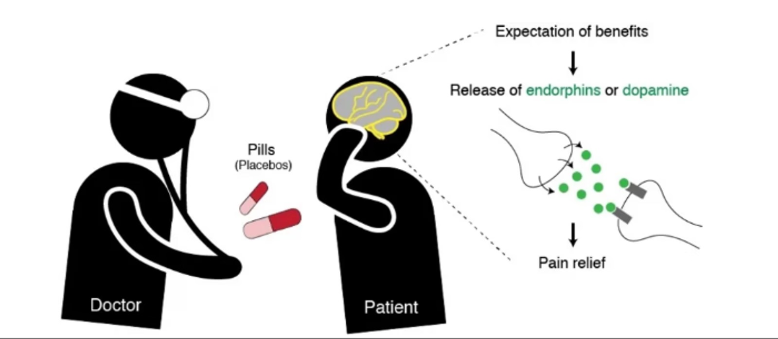 Effet placebo et douleur