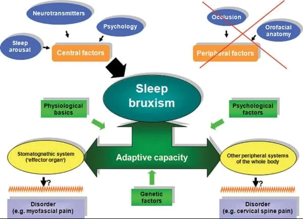 Diagram of the effects of sleep bruxism on the musculoskeletal system and the temporomandibular joint