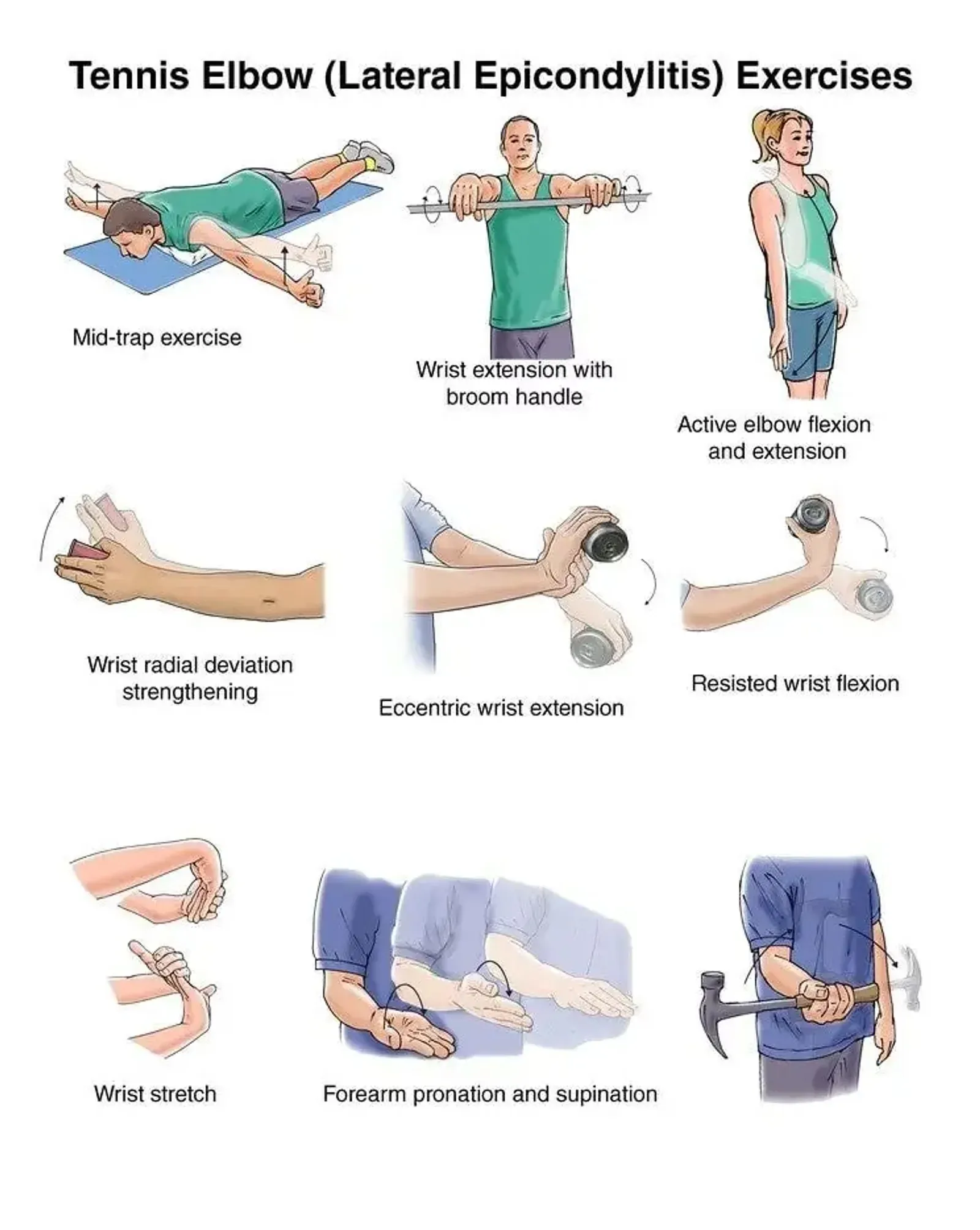 Rehabilitation exercises for lateral epicondylitis