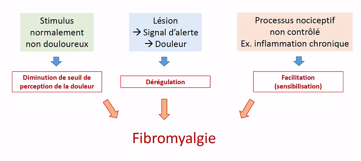 Mécanismes de la douleur dans la fibromyalgie