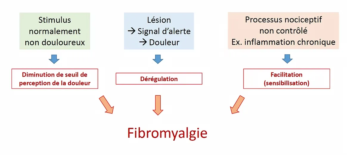 Mécanismes de la douleur dans la fibromyalgie