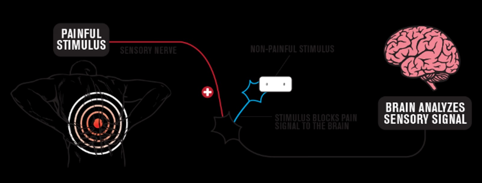 Mécanismes d'action du TENS dans la douleur