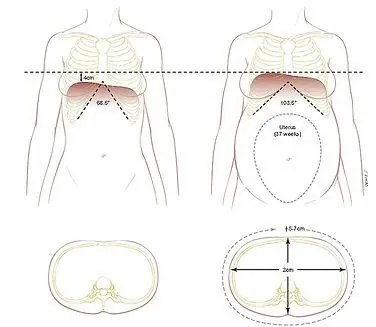 Changements diaphragme et cage thoracique durant la grossesse