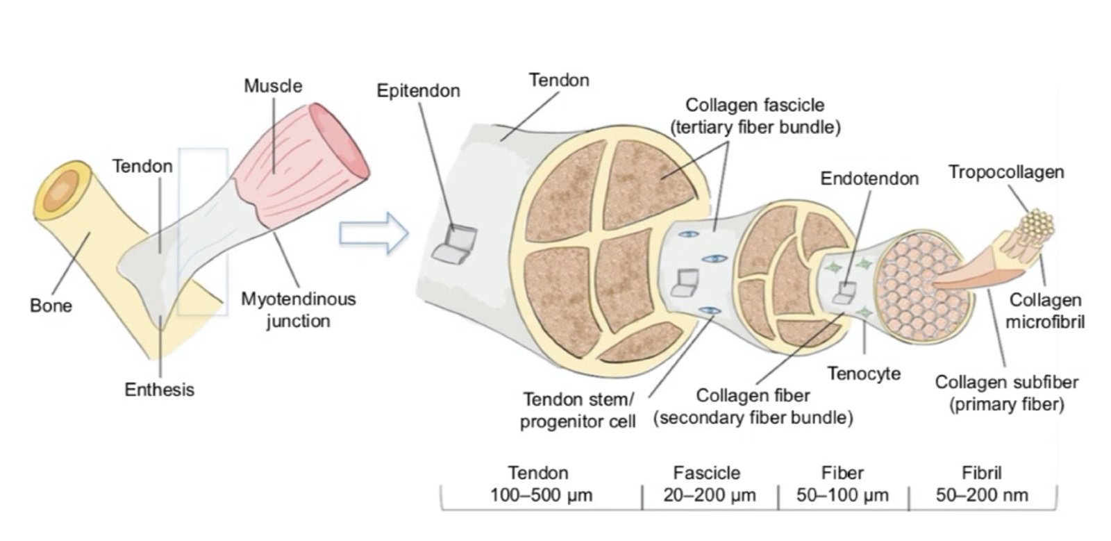 Physiopathologie et traitement de la tendinite