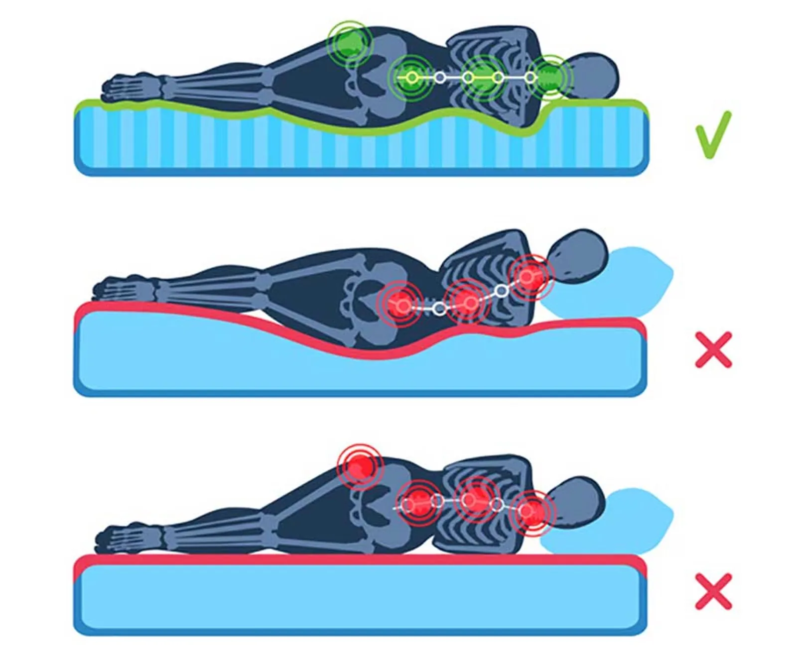 Which mattress for back pain. Osteopath Paris 16