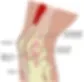 Iliotibial band syndrome, osteopath Paris 16