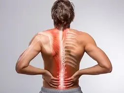 Myofascial pain syndrome treatment, osteopath Paris 16